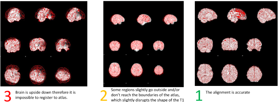 Atlas Registration Example